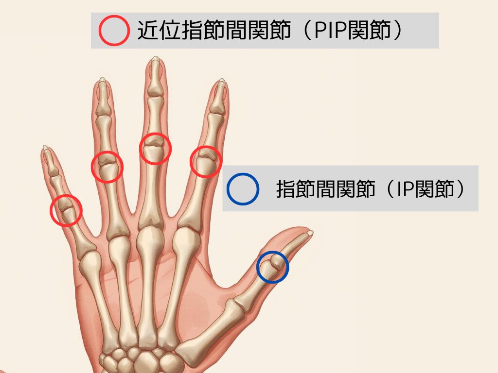 近位指節間関節(PIP関節)
指節間関節(IP関節)