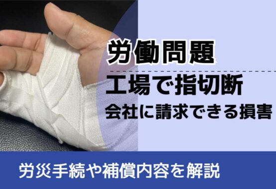 , , , 労働問題, 労災手続や補償内容を解説, 工場で指切断 会社に請求できる損害,