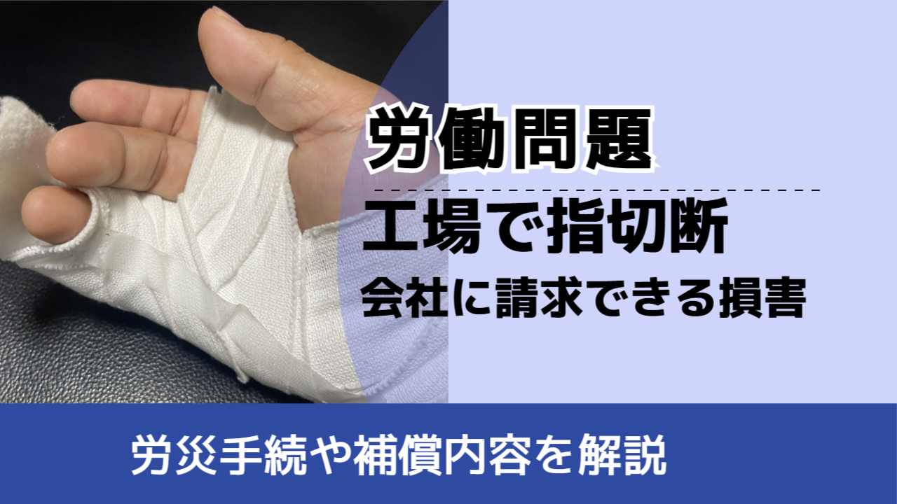 , , , 労働問題, 労災手続や補償内容を解説, 工場で指切断 会社に請求できる損害,